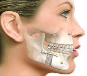 Buco-Maxilo-Facial Curitiba Buco-Maxilo-Facial Curitiba