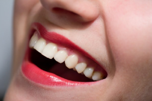 Estética Dental Curitiba Clareamento Dental Curitiba