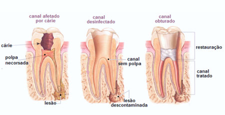 Clareamento Dental Curitiba