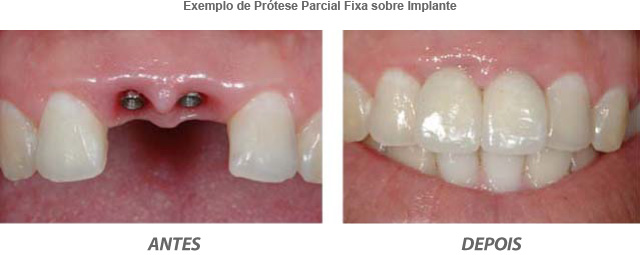 Dentista Curitiba