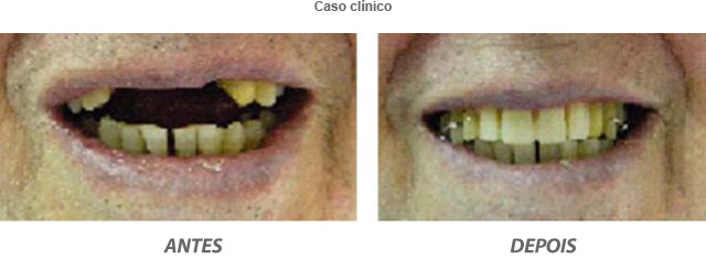 Dentista Curitiba