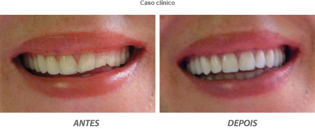Dentista Curitiba